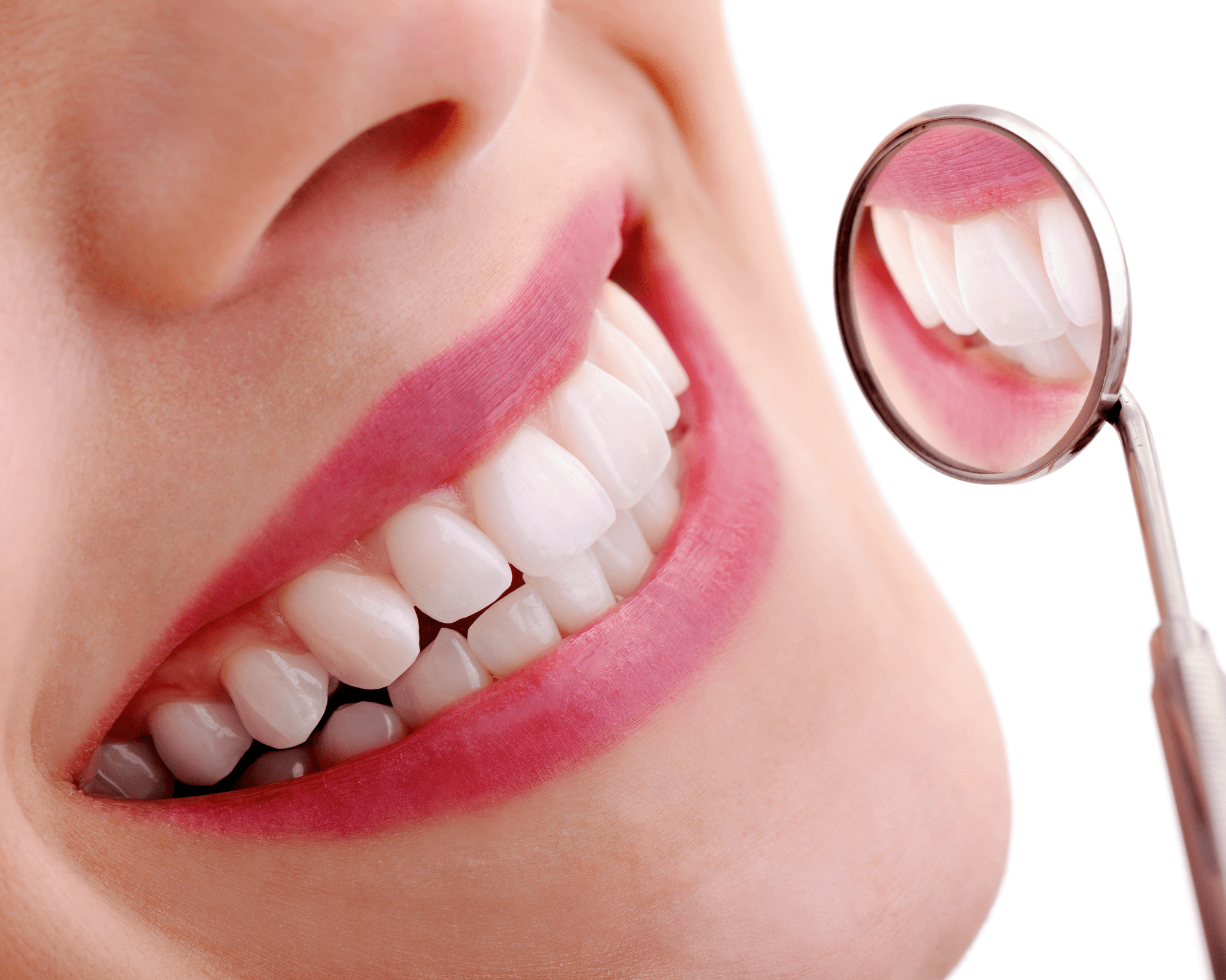 Close-up of smiling teeth with dental mirror